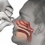 051120 – PageOne – swab
